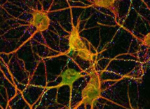 Hypnoscope Juin 2014 - Actualites Therapeutiques Hypnoscope Juin 2014 - Actualites Therapeutiques