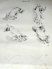 Hypnoscope Juillet 2014 - Actualités Therapeutiques Hypnoscope Juillet 2014 - Actualités Therapeutiques